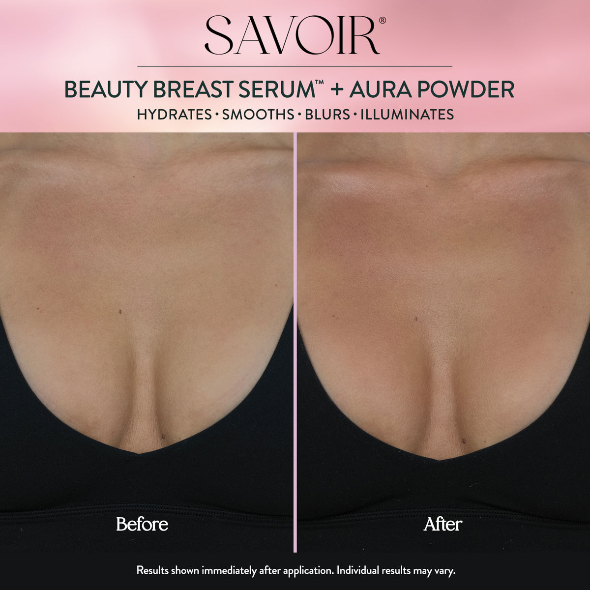 Breast Wishes™ Set